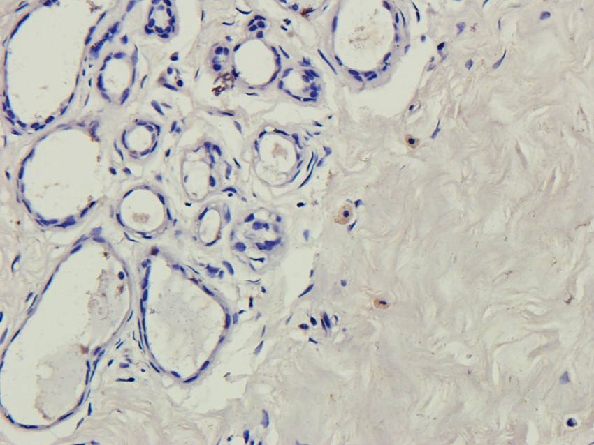 B7-H6 antibody