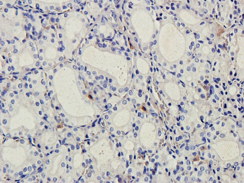 B7-H6 antibody