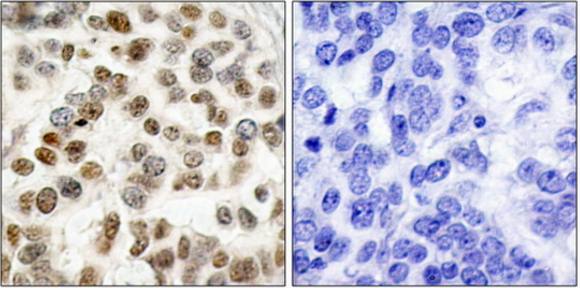 BRCA1 (Ab-1423) Antibody