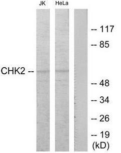 Chk2 (Ab-68) Antibody