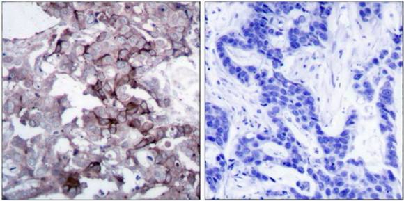 EGFR (Ab-1172) Antibody