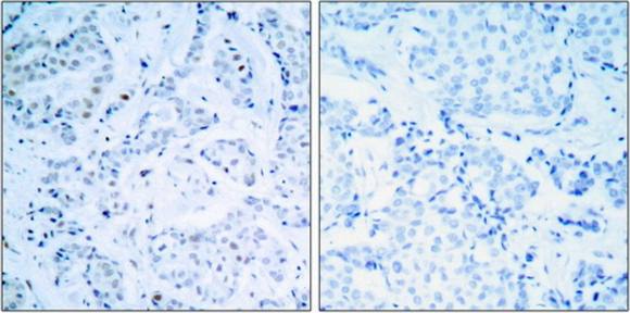 Estrogen Receptor-α (Ab-104) Antibody
