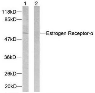 Estrogen Receptor-α (Ab-104) Antibody