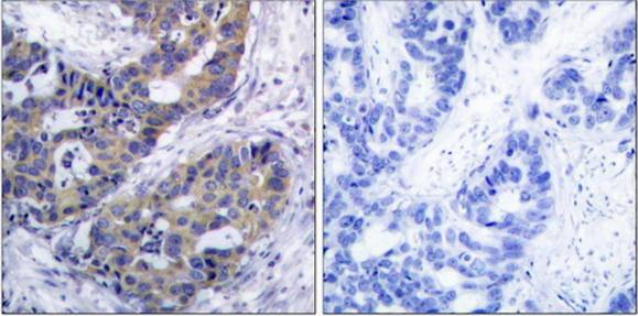 IRS-1 antibody