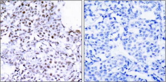 SMC1 (Ab-957) Antibody