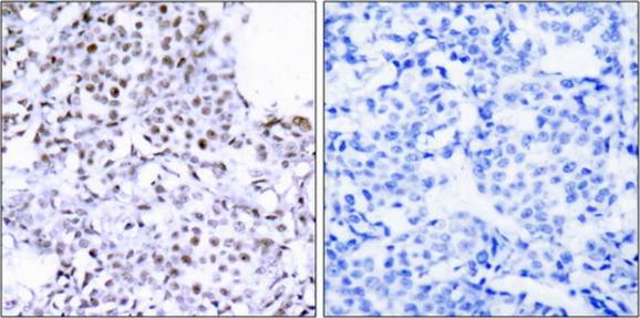 SMC1 antibody