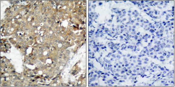 STAT1 antibody