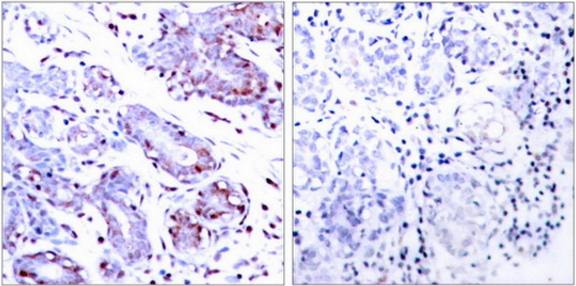 STAT1 antibody