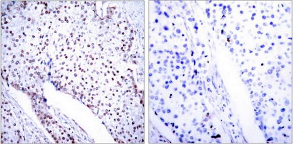 STAT3 (Ab-705) Antibody