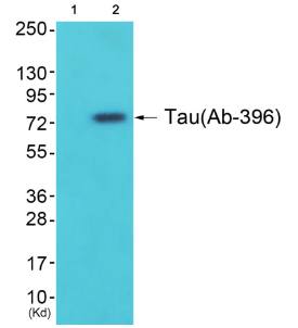 Tau (Ab-396) Antibody