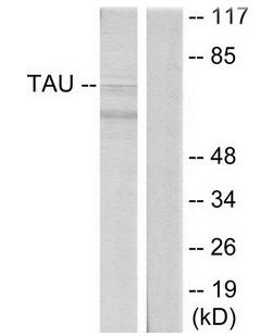 Tau (Ab-396) Antibody