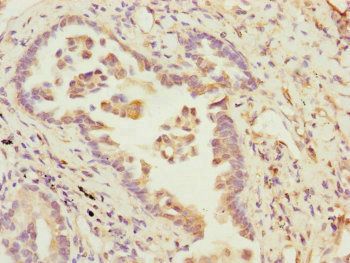 B9D2 Antibody