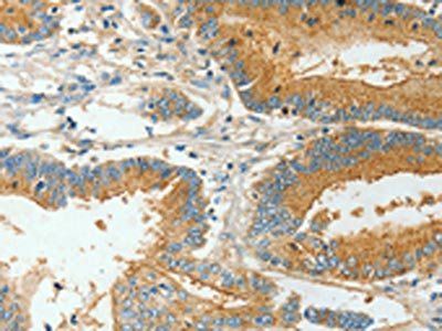 BAAT Antibody