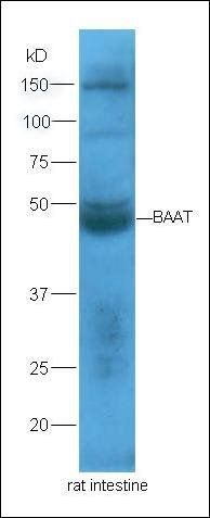 BAAT Rabbit Polyclonal Antibody
