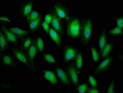 BABAM2 Antibody