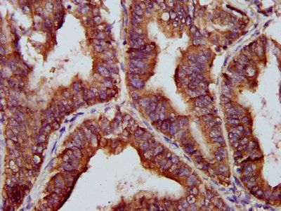 BABAM2 Antibody