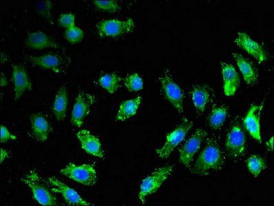 BACE1 Antibody