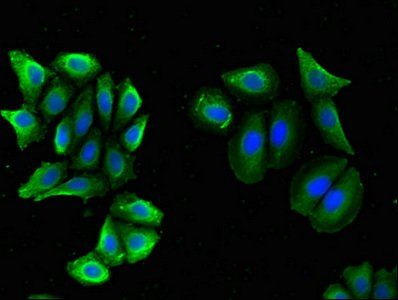 BACE2 antibody