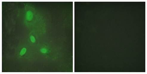 BACH1 Antibody