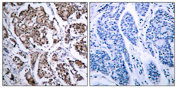 BAD(Phospho-Ser155) Antibody