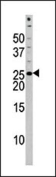 Bad (phospho-Ser118) antibody