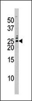 Bad (phospho-Ser75) antibody