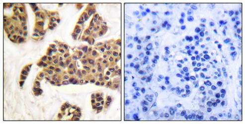 BAD (phospho-Ser91/128) antibody