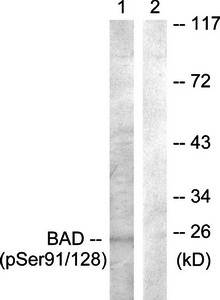 BAD (Phospho-Ser91/128) Antibody