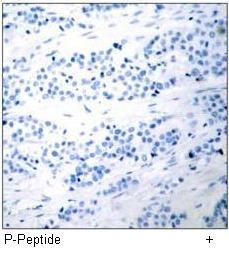 BAD (Phospho-Ser112) Antibody