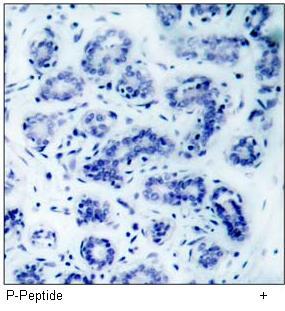 BAD (Phospho-Ser136) Antibody