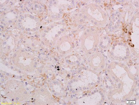 BAFFR Rabbit Polyclonal Antibody