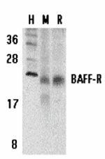 BAFF Receptor Antibody