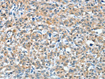 BAG3 Antibody