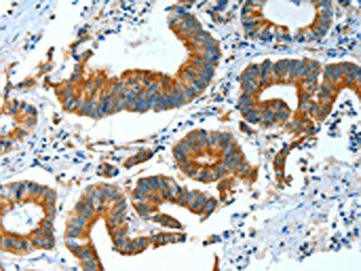 BAG3 Antibody