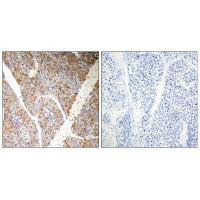 BAG3 Antibody