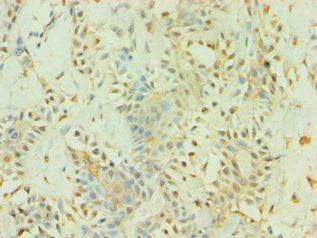 BAG5 Antibody