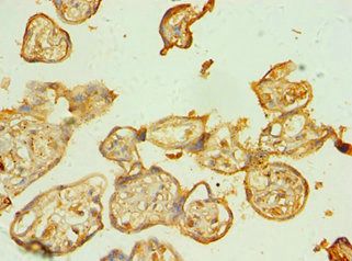 BAG5 Antibody
