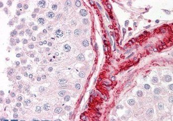 Goat anti-BAG5 (N Terminus) Antibody