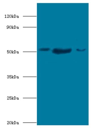 BAG5 Antibody