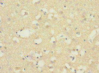 ADGRB1 Antibody