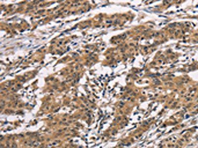 ADGRB1 Antibody