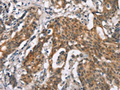 BAI2 Antibody
