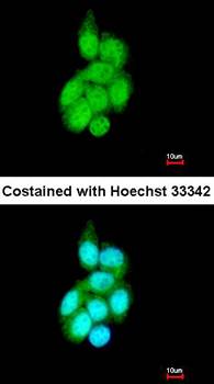 BAIAP2L1 antibody