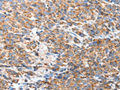 BAK1 Antibody