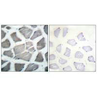 BAK1 Antibody
