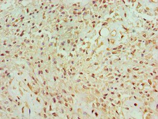 BANP Antibody