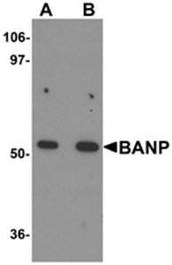 BANP Rabbit Polyclonal Antibody