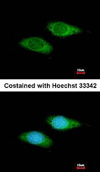 basic beta 2 syntrophin antibody