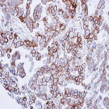 basic beta 2 syntrophin antibody