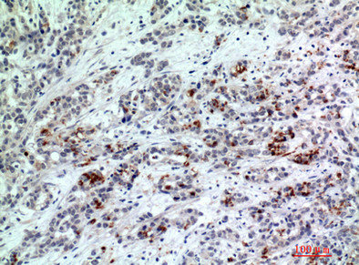 BATF3 Antibody